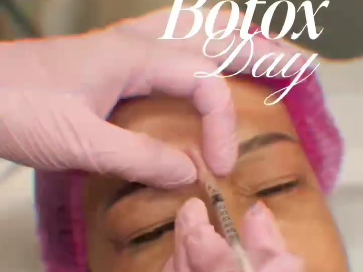 Aplicação real de toxina botulínica (botox) na testa durante o Botox Day da clínica